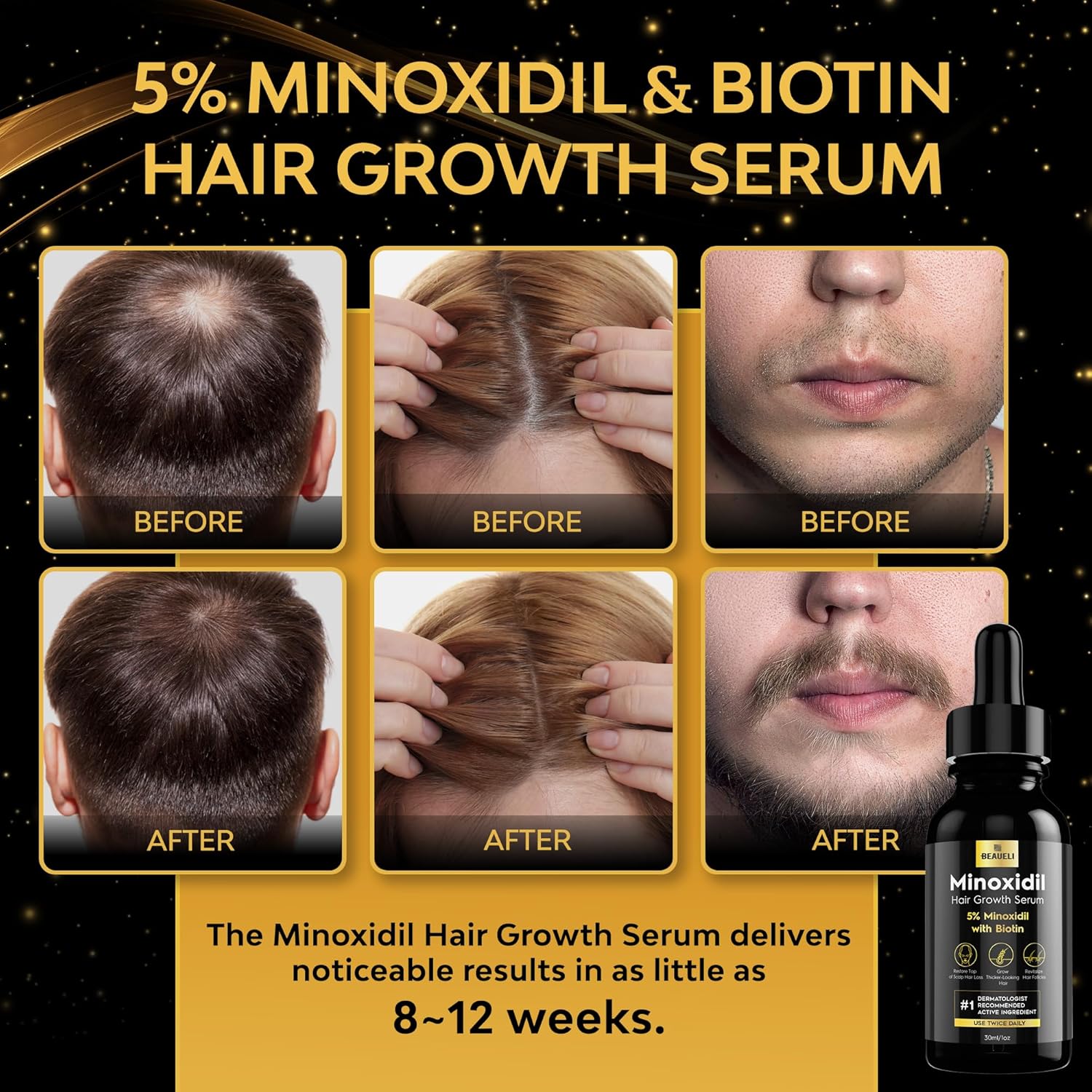 beaueli 5% Minoxidil for Men & Women Hair Growth, Beard Growth, Hair Loss Treatment, Unisex Adult 1oz - Image 2
