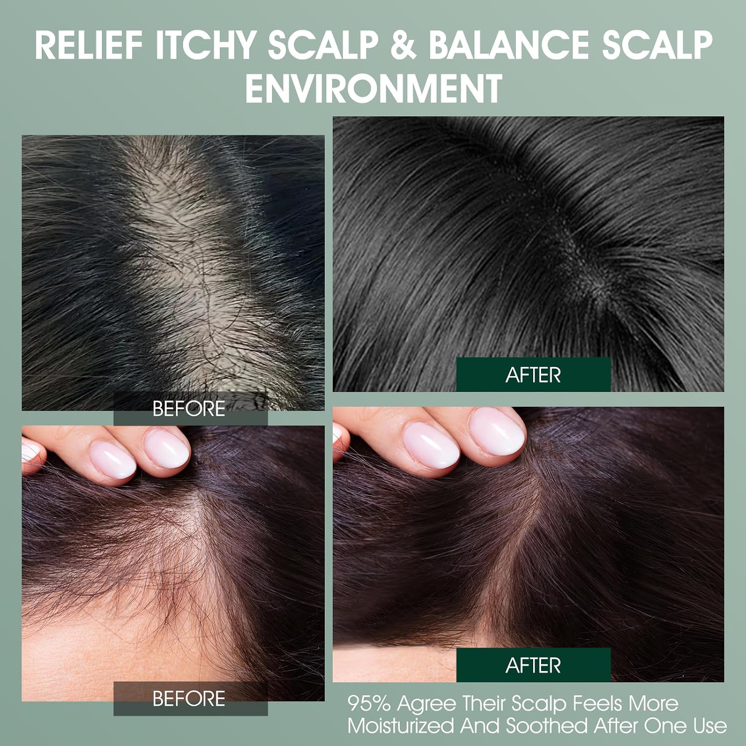 VOERUY Scalp Treatment, Rosemary Refreshing Scalp Treatment with Tea Tree, Clarifying Build Up & Purifying, Leave-In Scalp Detox for Dry Itchy Scalp,Vegan & Cruelty-Free,120ML - Image 5