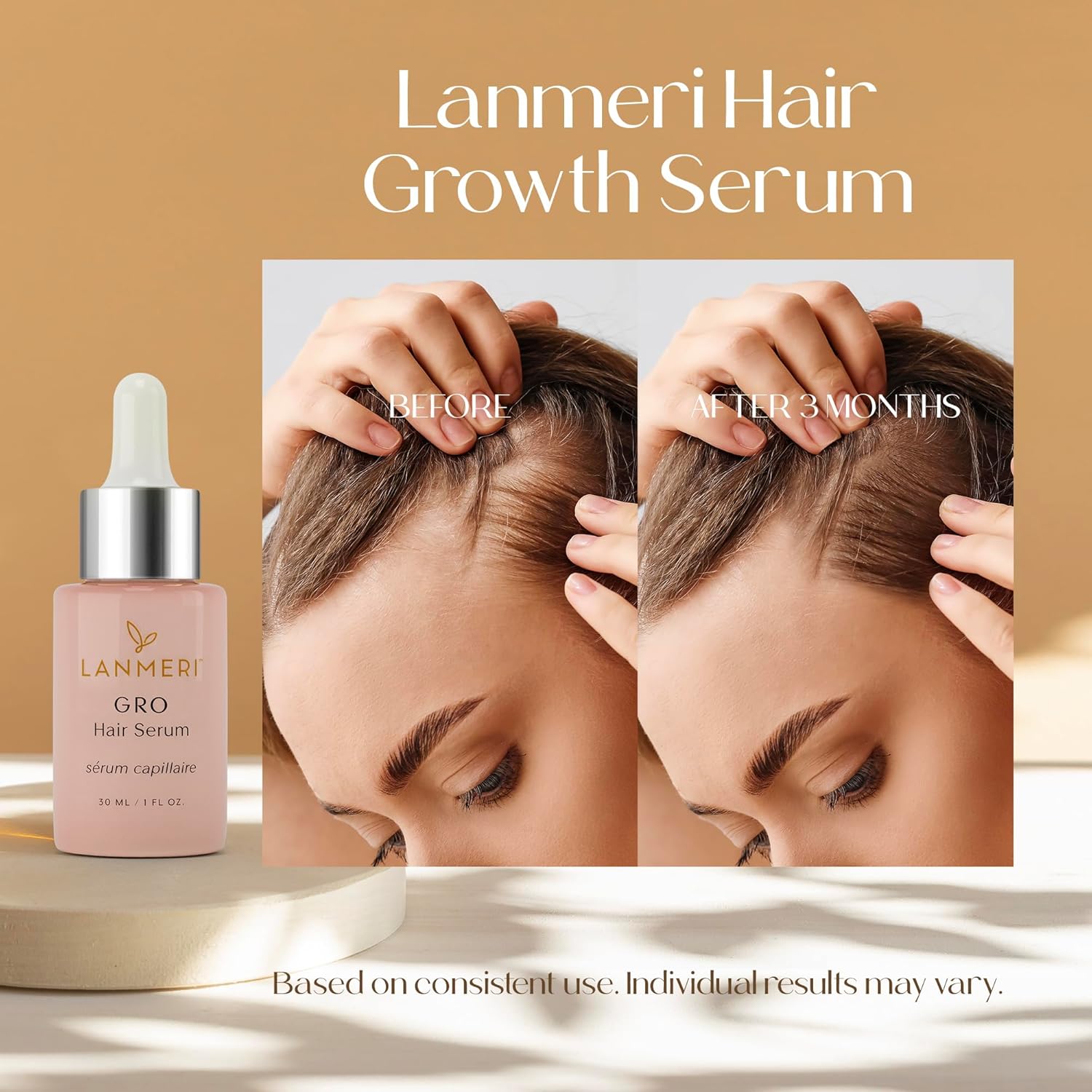 Lanmeri Vegan Hair Growth Serum for Women & Men - Natural Scalp Treatment for Thinning Hair and Hair Regrowth - Fuller-looking, Thicker and Healthier Hair in 90 Days, All Hair Types - Image 2