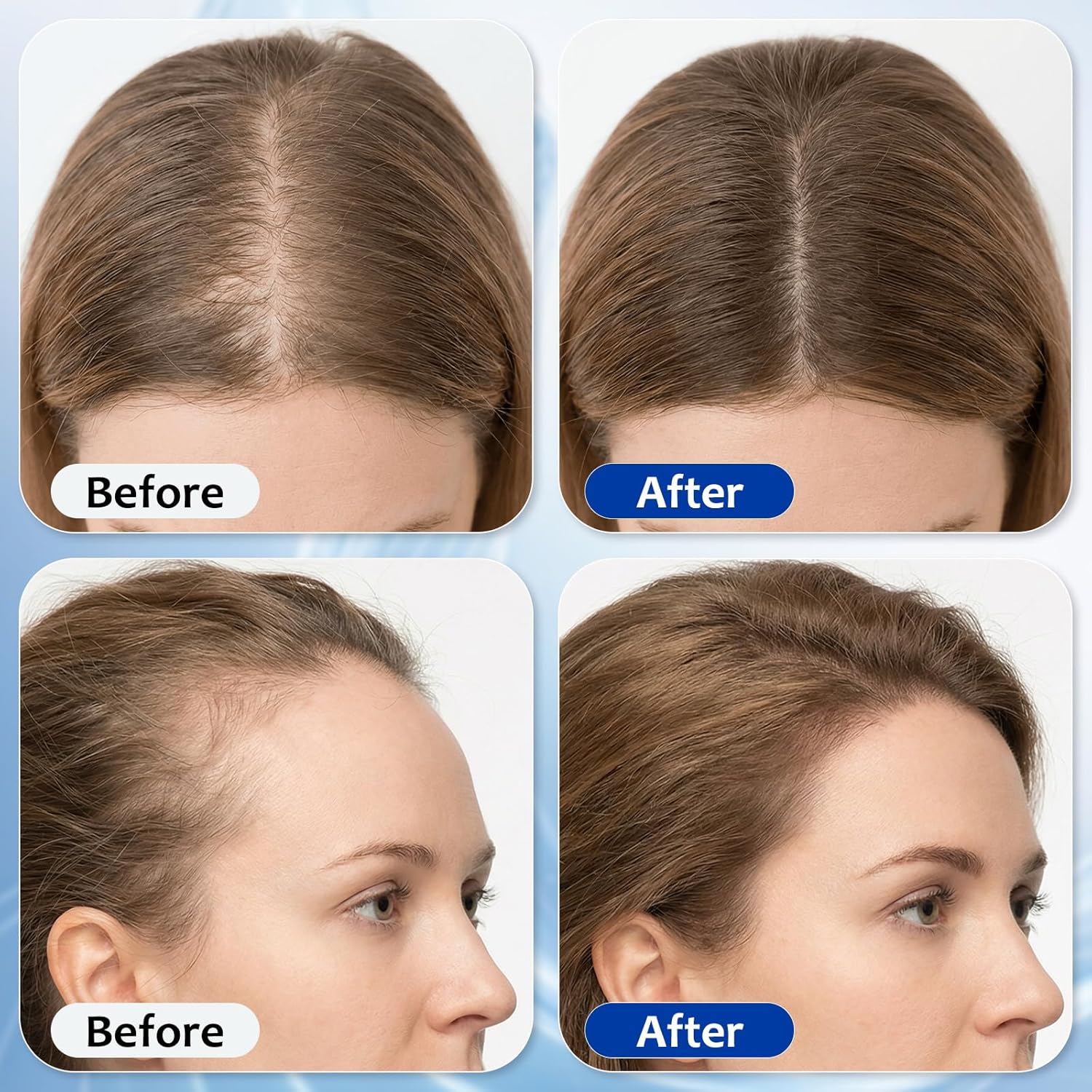 Hair Growth Serum Roll On with 3% Rosemary,3% Batana Oil,2% Pea Extract,2% Ginger Root Oil,Stronger Root,stimulate follicle,Hair Thicker,Hair Loss Treatment,Hair Growth Serum(30ML/1.01FL.OZ) - Image 4