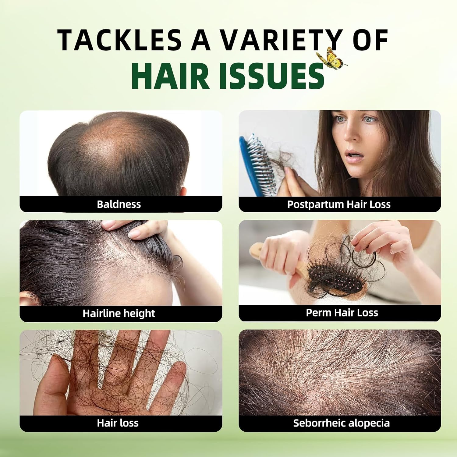 Rosemary Hair Growth Shampoo and Conditioner Set: Thickness & Anti Hair Loss Shampoo and Conditioner with Tea Tree Oil Mint Biotin – Strengthening Formula for Men & Women, Thinning & Damaged Hair Care - Image 4