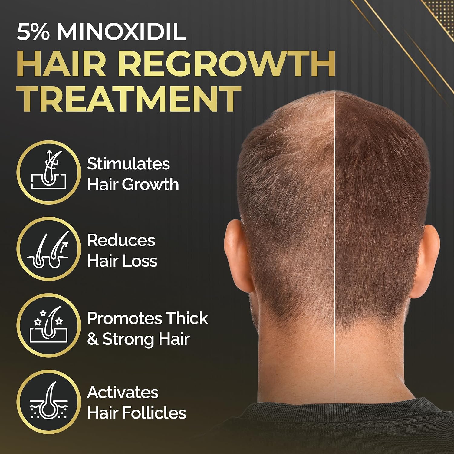 Elevate Hair Regrowth Treatment 5% Minoxidil Solution for Hair Growth - Extra Strength Topical Hair Growth Serum for Thicker, Fuller Hair 2 Fl Oz Made in USA - Image 5
