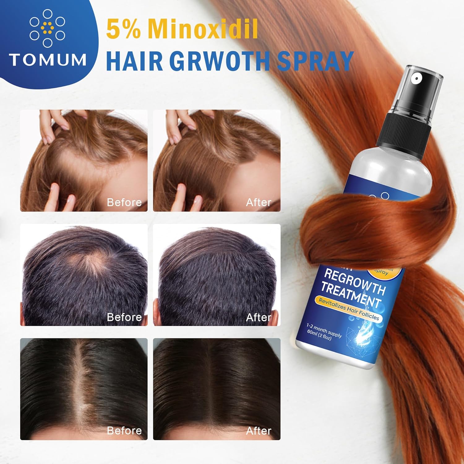 Minoxidil for Men and Women Hair Growth: 5% Minoxidil Topical Spray Hair Regrowth Treatment Stop Hair Thinning and Hair Loss For Stronger Thicker Longer Hair 60ml 2 Pack - Image 7