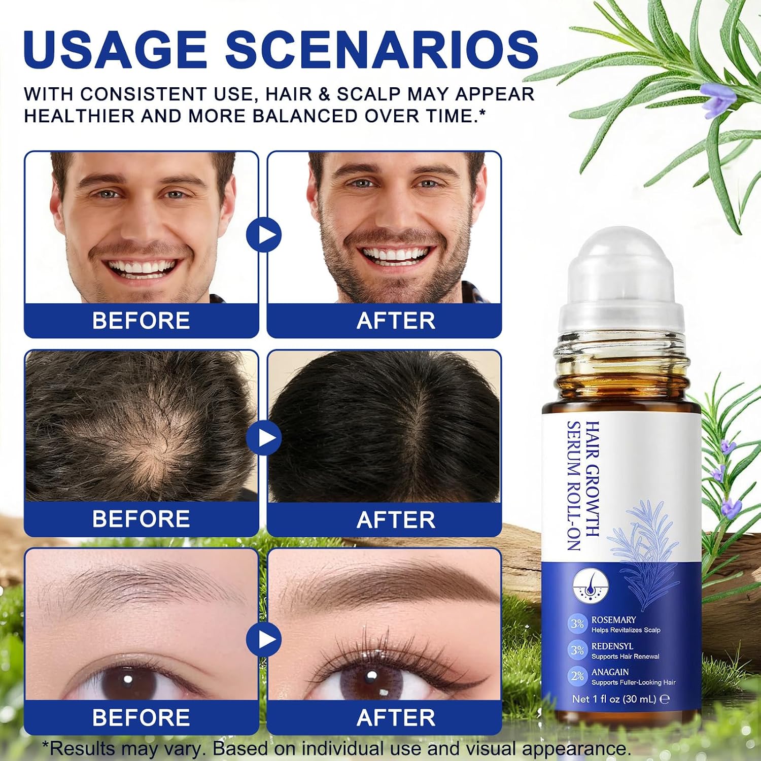 Hair Growth Serum Roll On, 30ml Hair Growth Oil with 3% Rosemary, 3% Redensyl, 2% Anagain, Hair Growth Serum Rosemary Oil for Hair Growth to Help Nourish Hair Follicles, Support Scalp Health - Image 5