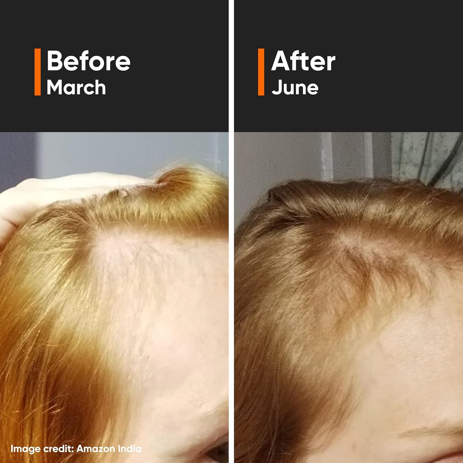 Minimalist Hair Density Serum 18% | Hair Growth Serum With Procapil, Capixyl, Redensyl, Anagain & Baicapil For Hair Fall Control | Women & Men | 30 ml | 18% - Image 9
